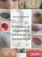 Problemas de diagnóstico diferencial en dermatología